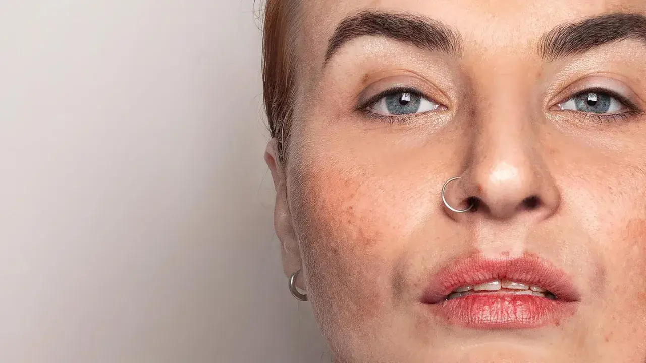 Nahaufnahme eines Gesichts mit Sommersprossen und einem Nasenring. Die Haut zeigt Anzeichen von haut regeneration.