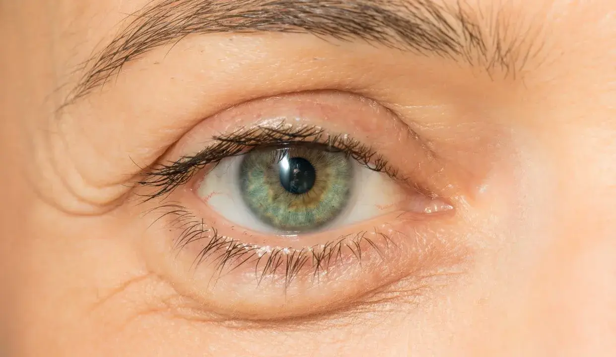 Nahaufnahme eines Auges mit knittriger Haut unter den Augen. Suche nach Hausmittel gegen Falten.