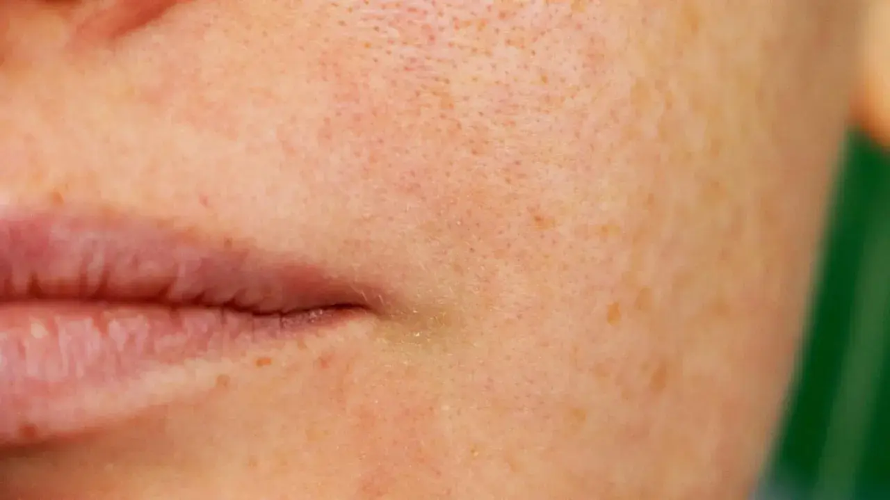 Nahaufnahme der Haut mit sichtbaren Poren und Sommersprossen. Eine sanfte Pflege, was verfeinert die Poren, kann das Hautbild verbessern.