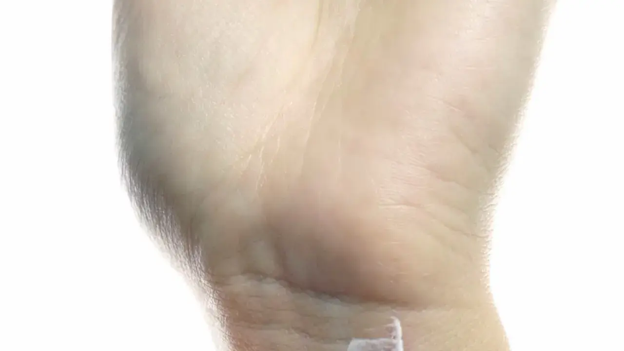Eine Hand mit trockener Haut, die eine kleine Wunde mit Salbe versorgt. Ein Zeichen für einen Mangel an Feuchtigkeit.