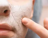 Nahaufnahme eines Gesichts mit einer trockenen, rissigen Maske. Ein Finger berührt sanft die Haut, um zu zeigen, wie man trockene Haut von innen behandeln kann.