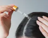 Eine Hand trägt mit einer Pipette Öl auf die Kopfhaut auf, um trockene Kopfhaut mit Hausmitteln zu behandeln.