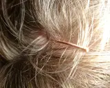 Nahaufnahme einer juckenden Kopfhaut mit feinen Haaren und einer dünnen, kupferfarbenen Haarschnecke.