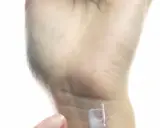 Eine Hand mit trockener Haut, die eine kleine Wunde mit Salbe versorgt. Ein Zeichen für einen Mangel an Feuchtigkeit.