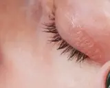 Nahaufnahme einer trockenen Stelle unterm Auge, die mit einem dunklen Nagellackstift berührt wird.
