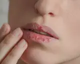 Trockene, rissige Lippen, die fast platzen auf, werden von einer Hand berührt.