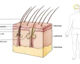 Schnitt durch die Haut zeigt Haarfollikel, Talgdrüsen und einen Mitesser, der aus Talg und Hornsubstanz besteht. Daneben ein schematischer Mensch.