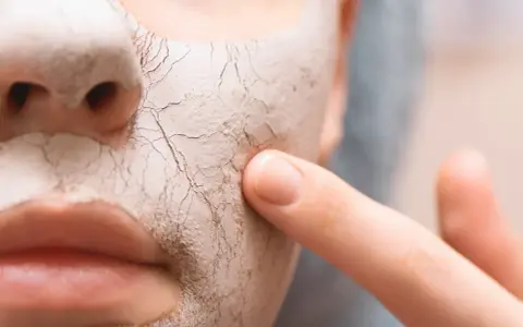 Nahaufnahme eines Gesichts mit einer trockenen, rissigen Maske. Ein Finger berührt sanft die Haut, um zu zeigen, wie man trockene Haut von innen behandeln kann.