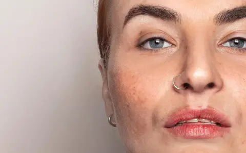 Nahaufnahme eines Gesichts mit Sommersprossen und einem Nasenring. Die Haut zeigt Anzeichen von haut regeneration.