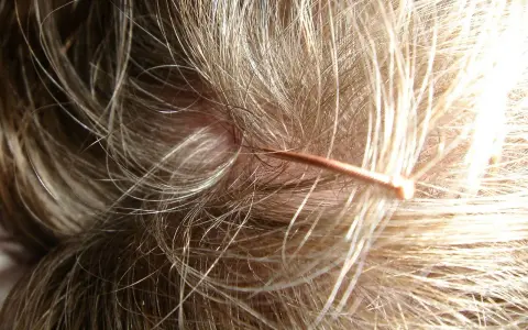 Nahaufnahme einer juckenden Kopfhaut mit feinen Haaren und einer dünnen, kupferfarbenen Haarschnecke.