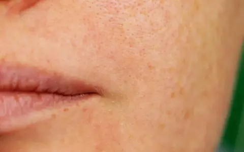 Nahaufnahme der Haut mit sichtbaren Poren und Sommersprossen. Eine sanfte Pflege, was verfeinert die Poren, kann das Hautbild verbessern.