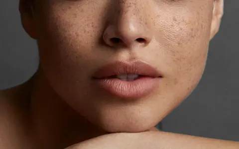 Nahaufnahme eines Gesichts mit Sommersprossen und perfekt geschminkten **Ombre Lippen**.
