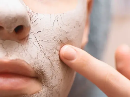 Nahaufnahme eines Gesichts mit einer trockenen, rissigen Maske. Ein Finger berührt sanft die Haut, um zu zeigen, wie man trockene Haut von innen behandeln kann.