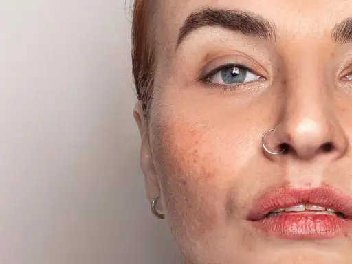 Nahaufnahme eines Gesichts mit Sommersprossen und einem Nasenring. Die Haut zeigt Anzeichen von haut regeneration.