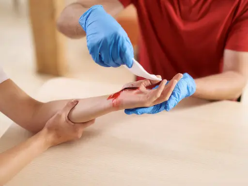 Person mit blauen Handschuhen versorgt Schnittwunde an der Hand, die beim Rasieren geschnitten wurde.