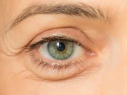 Nahaufnahme eines Auges mit knittriger Haut unter den Augen. Suche nach Hausmittel gegen Falten.