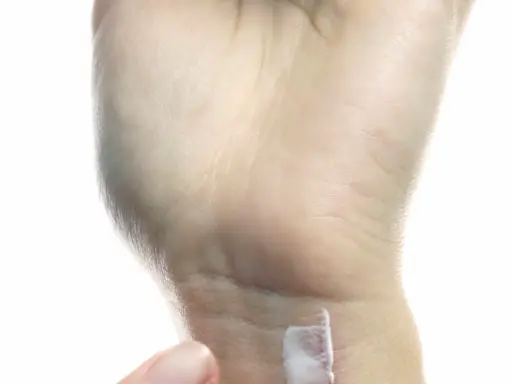 Eine Hand mit trockener Haut, die eine kleine Wunde mit Salbe versorgt. Ein Zeichen für einen Mangel an Feuchtigkeit.