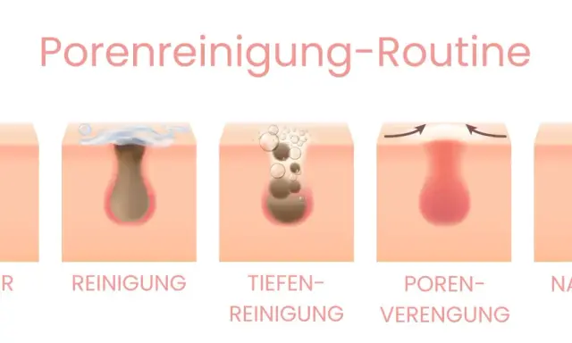 Illustration zeigt die Reinigung von Poren, die schwarze Punkte auf der Haut enthalten. Die Schritte umfassen Vorher, Reinigung, Tiefenreinigung, Porenverengung und Nachher.