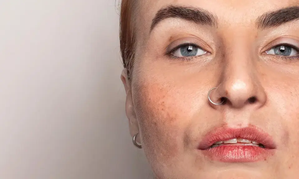 Nahaufnahme eines Gesichts mit Sommersprossen und einem Nasenring. Die Haut zeigt Anzeichen von haut regeneration.