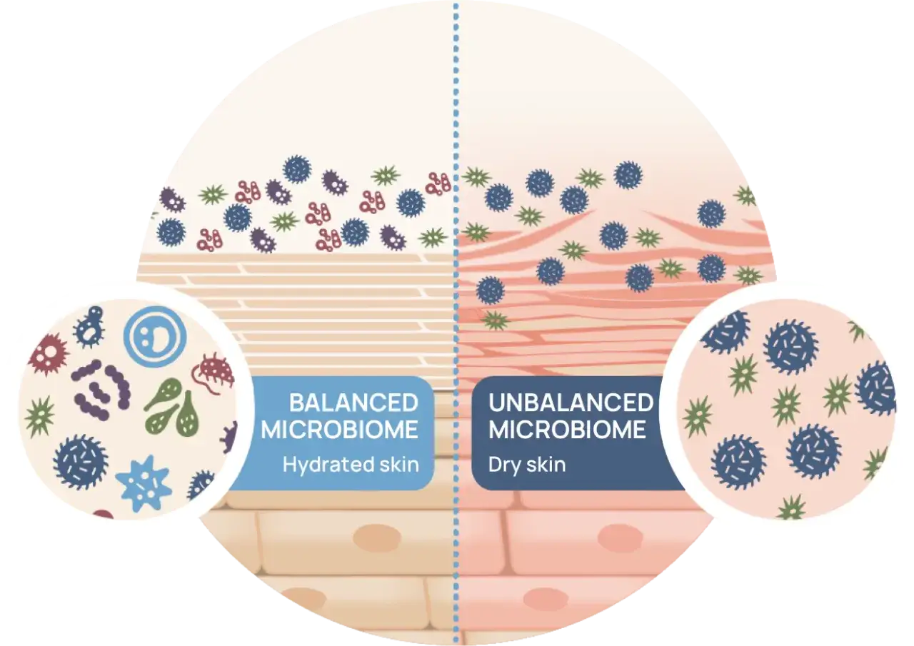 Vergleich von Hautmikrobiomen: Links ein ausgewogenes Mikrobiom für hydrierte Haut, rechts ein unausgewogenes für trockene Haut. Die residente Hautflora spielt eine Rolle.