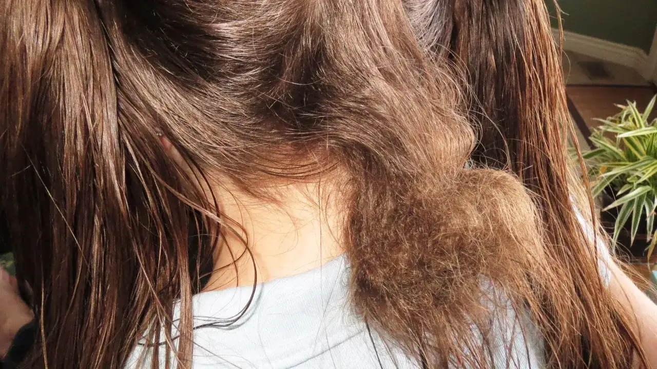Ein Knäuel verfilzte Haare am Nacken, umgeben von langen, feuchten Strähnen.